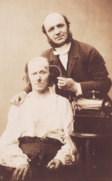Guillaume Duchenne De Boulogne - Faradisation du muscle frontal, 1862